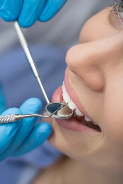 Dentista che esamina un paziente denti nel dentista. — Foto Stock
