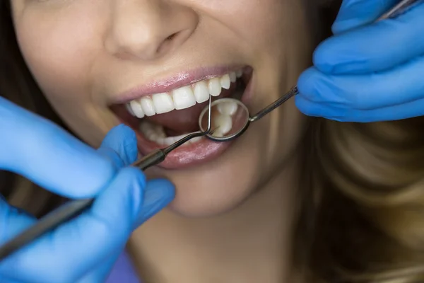 Tandarts onderzoekt een patiënt tanden in de tandarts. — Stockfoto