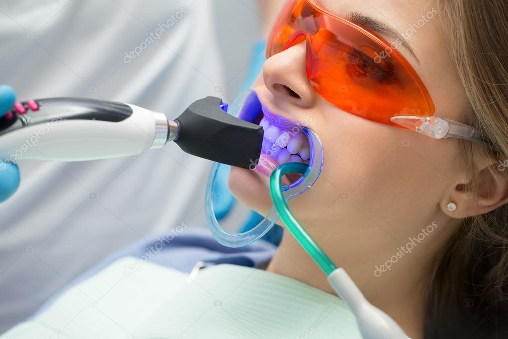Tooth filling ultraviolet lamp Stock Photo by ©bezikus 96346784