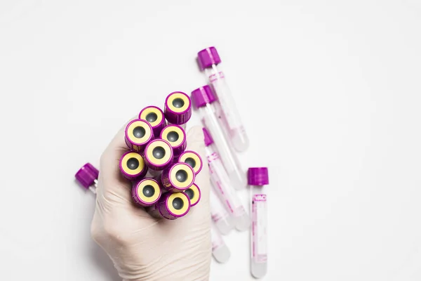 Labaroth Çalışmaları Kan Testleri Için Medecin Test Tüpleri Tıbbi Ekipmanlar — Stok fotoğraf