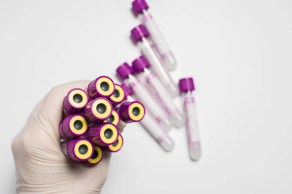 Labaroth Çalışmaları Kan Testleri Için Medecin Test Tüpleri Tıbbi Ekipmanlar — Stok fotoğraf