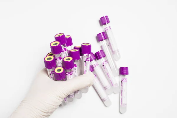 Tubos de ensayo de medecin para estudios labaroth y análisis de sangre. Equipos. —  Fotos de Stock