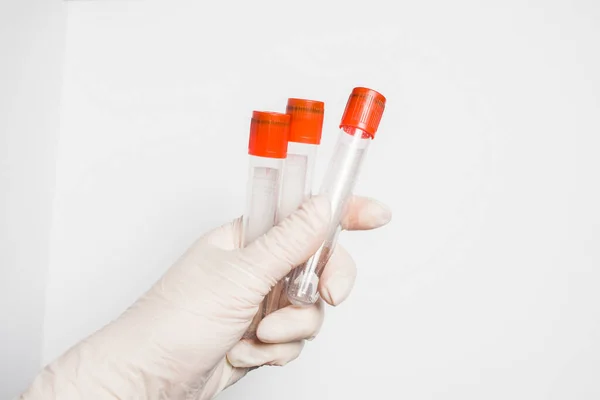 Medecin test tubes for labaroth studies and blood tests. Equipment.