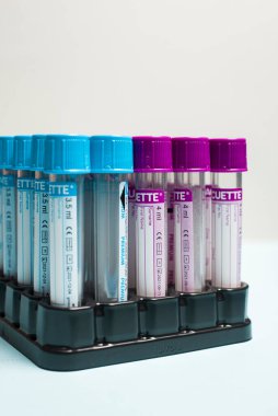Labaroth çalışmaları ve kan testleri için Medecin test tüpleri. Tıbbi ekipmanlar. Coronavirus Covid-19 aşı araştırması