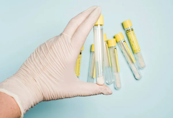 Перевірка медецинових труб для дослідження лапарот і кров "яних тестів.. — стокове фото