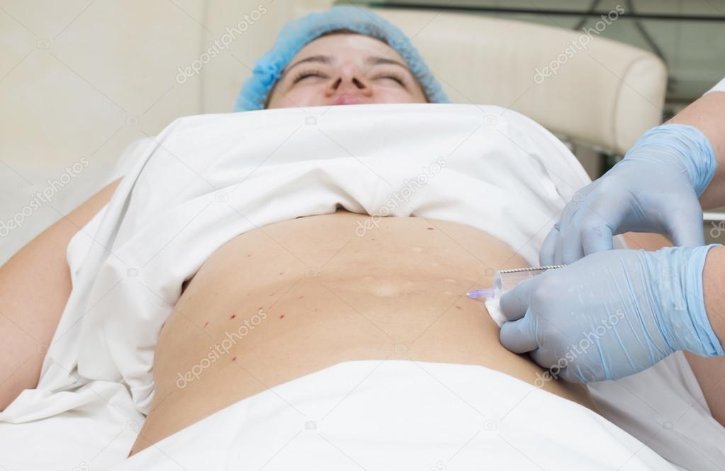 woman is in the process cellulite