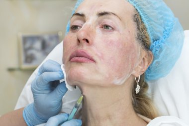 Enjeksiyon ile kozmetik tedavi