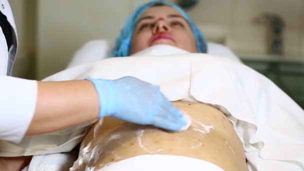 Vrouw is in het proces cellulitis — Stockvideo