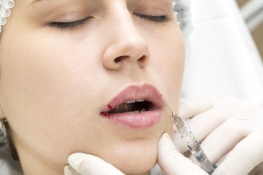 Kontur plastik dudaklar