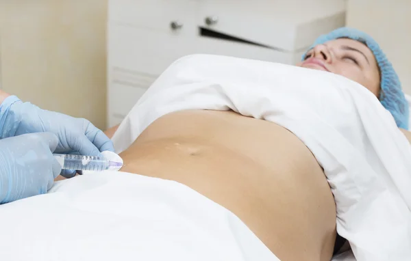 Женщина находится в процессе целлюлитной мезотерапии — стоковое фото