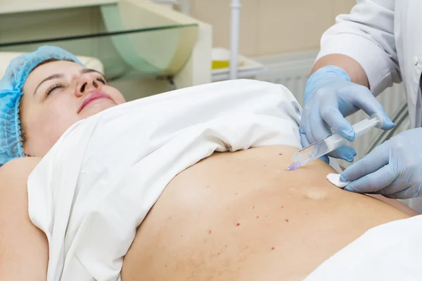Женщина находится в процессе целлюлитной мезотерапии — стоковое фото