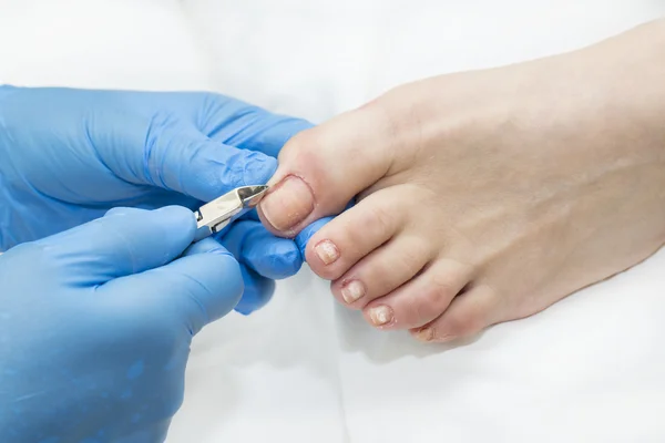 Medicinal Pedicure. The Doctor Removes The Imprint On The Foot With A  Scalpel Stock Photo, Picture and Royalty Free Image. Image 76932829.