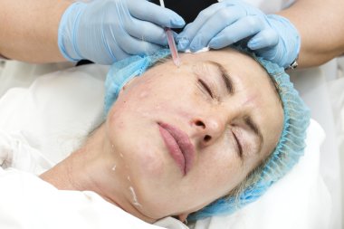 Enjeksiyon ile kozmetik tedavi