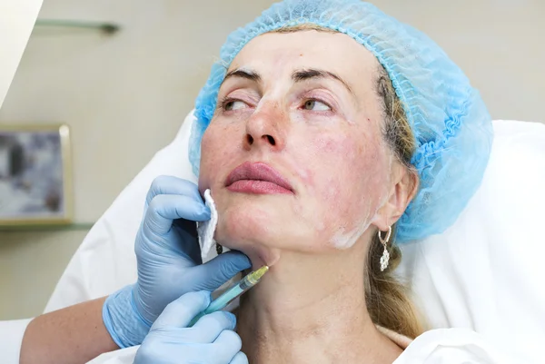 Tratamento cosmético com injeção — Fotografia de Stock