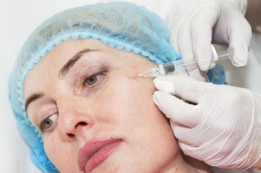 kozmetik tedavisi botox enjeksiyonu ile