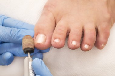 Pedikür süreci