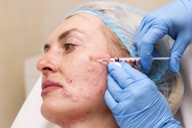 kozmetik tedavisi botox enjeksiyonu ile