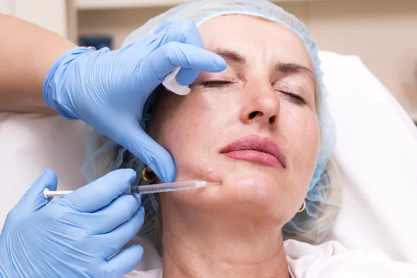 Kosmetisk behandling med botox injektion — Stockfoto