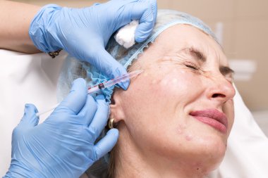 kozmetik tedavisi botox enjeksiyonu ile