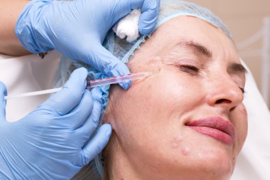 kozmetik tedavisi botox enjeksiyonu ile