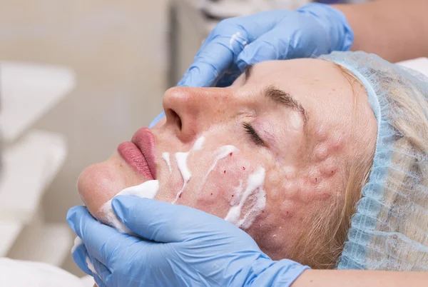 Cosmetic treatment with botox injection — Stock Photo, Image