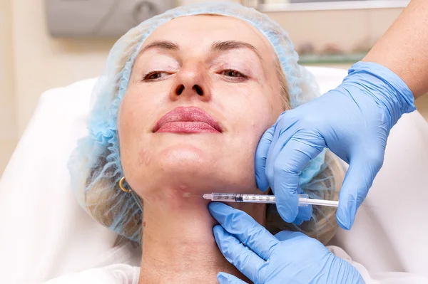 Kosmetisk behandling med botox injektion — Stockfoto