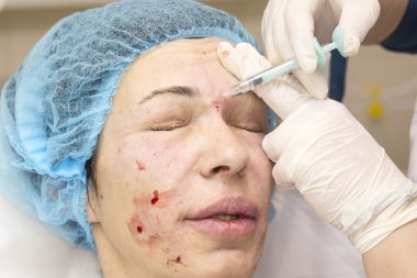 Enjeksiyon ile kozmetik tedavi