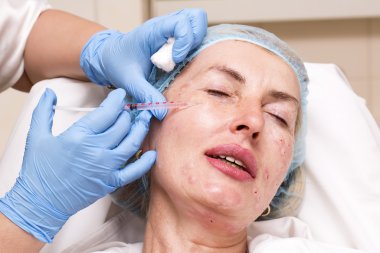 Enjeksiyon ile kozmetik tedavi