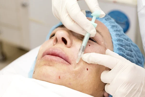 Cosmetic treatment with injection — Stock Photo, Image