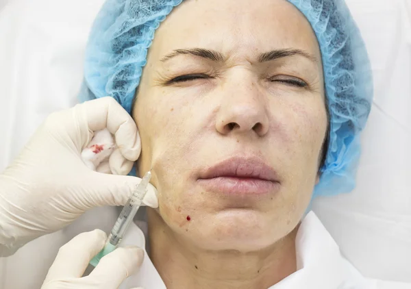 Cosmetic treatment with injection — Stock Photo, Image