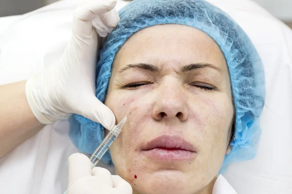 Kosmetische Behandlung mit Injektion — Stockfoto