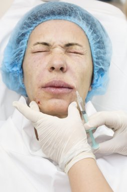 Enjeksiyon ile kozmetik tedavi