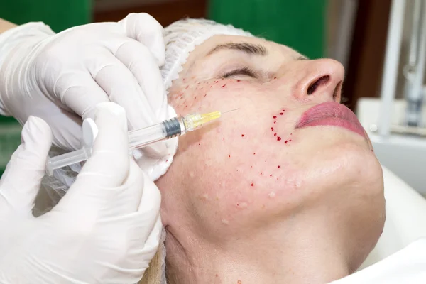 Tratamento cosmético com injeção — Fotografia de Stock