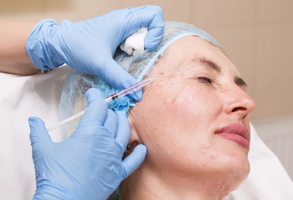 Cosmetic treatment with injection — Stock Photo, Image