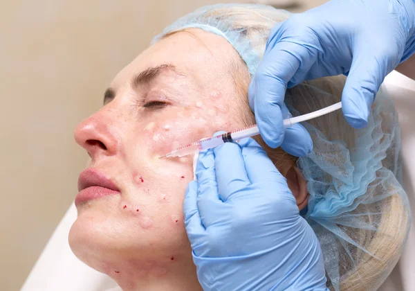Cosmetic treatment with injection — Stock Photo, Image