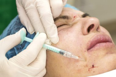 Enjeksiyon ile kozmetik tedavi