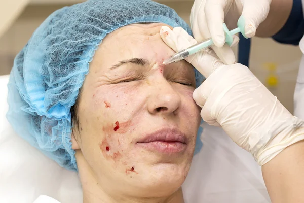Kosmetické ošetření s injekcí — Stock fotografie