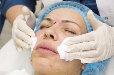 Enjeksiyon ile kozmetik tedavi