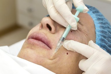 Enjeksiyon ile kozmetik tedavi