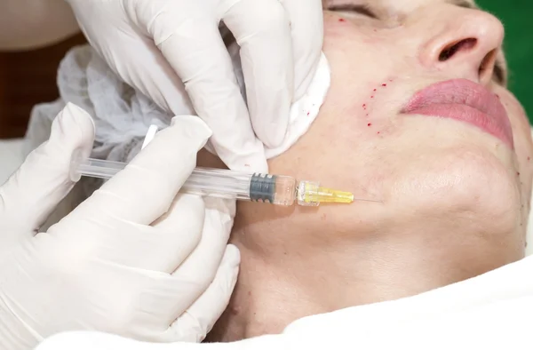 Cosmetic treatment with injection — Stock Photo, Image