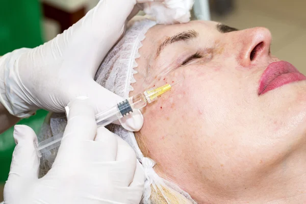 Enjeksiyon ile kozmetik tedavi — Stok fotoğraf