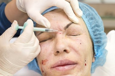 Enjeksiyon ile kozmetik tedavi