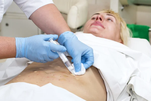 Woman during cellulite mesotherapy — Stock Photo, Image