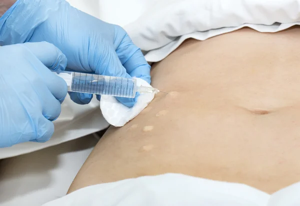 Mujer durante la mesoterapia de celulitis — Foto de Stock