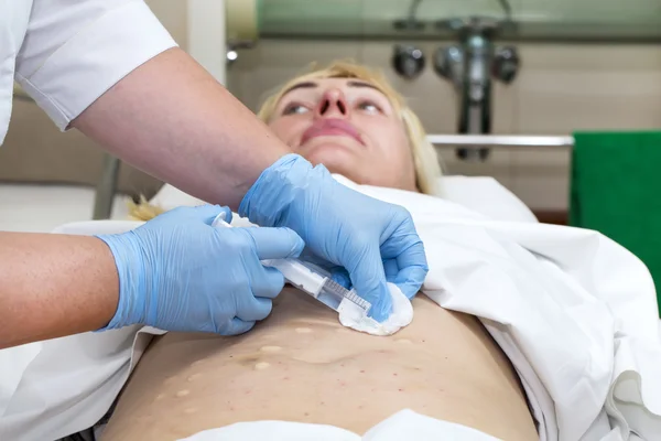 Mujer durante la mesoterapia de celulitis — Foto de Stock