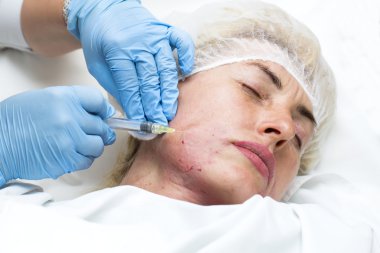 Enjeksiyon ile kozmetik tedavi