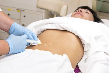 işlem selülit kadındır