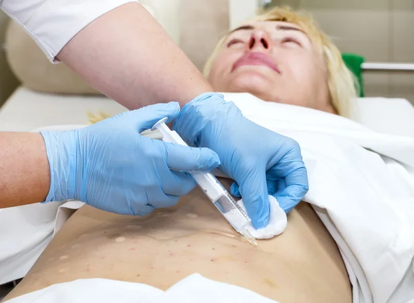 Mujer está en el proceso de celulitis — Foto de Stock