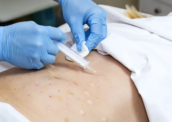 işlem selülit kadındır