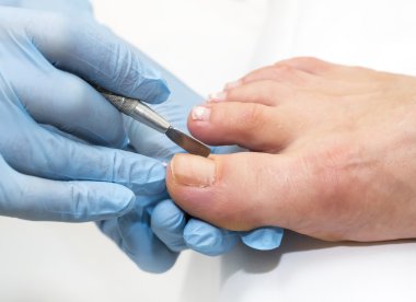 Pedikür süreci